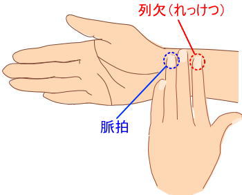 頭部・頸部の痛みやコリに効く【列缺（れっけつ）】｜富津市のSANRI鍼灸整骨院